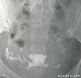 原料药在造影剂中所起的作用_MOL:ppt插件onekeylite怎么安装
